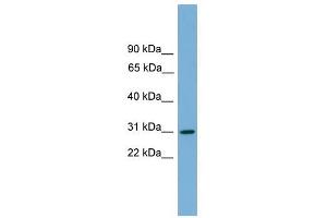HLA-DQA2 antibody used at 1 ug/ml to detect target protein. (HLA-DQA2 antibody  (Middle Region))