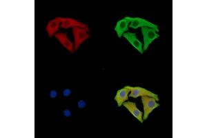 ABIN7095950 and ABIN7100012 staining Hela cells by IF/ICC. (SCYL3 antibody)