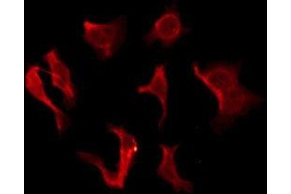 OR2B2 antibody  (Internal Region)