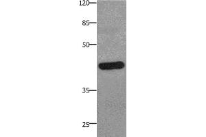 Western Blotting (WB) image for anti-Prostaglandin E Receptor 2 (Subtype EP2), 53kDa (PTGER2) antibody (ABIN2425819)