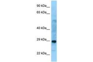 Image no. 1 for anti-Proline Synthetase Co-Transcribed (PROSC) (C-Term) antibody (ABIN6748163) (PROSC antibody  (C-Term))