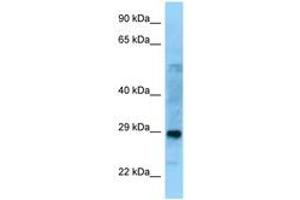 Image no. 1 for anti-Proline Synthetase Co-Transcribed (PROSC) (C-Term) antibody (ABIN6748163) (PROSC antibody  (C-Term))
