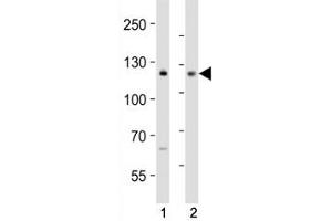 Western blot analysis of lysate from (1) MCF-7 and (2) Jurkat cell line using NOTCH antibody at 1:1000. (Notch1 antibody  (C-Term))