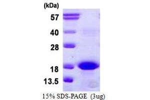 Image no. 1 for BCL2-Related Protein A1 (BCL2A1) protein (His tag) (ABIN1098615) (BCL2A1 Protein (His tag))