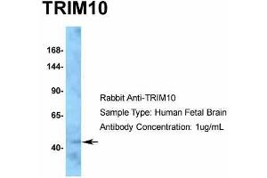 Hum. (TRIM10 antibody  (C-Term))