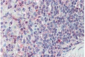 Anti-CD70 antibody  ABIN960751 IHC staining of human spleen. (CD70 antibody  (N-Term))