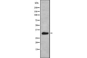 Western blot analysis of BAM32 using HeLa whole cell lysates