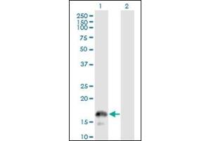 Western Blotting (WB) image for anti-CD247 Molecule (CD247) (AA 1-165) antibody (ABIN782349) (CD247 antibody  (AA 1-165))