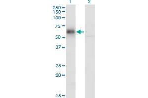 Western Blot analysis of GDI1 expression in transfected 293T cell line by GDI1 monoclonal antibody (M08), clone 1H3. (GDI1 antibody  (AA 1-447))