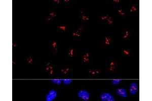 Confocal immunofluorescence analysis of U2OS cells using KRR1 Polyclonal Antibody at dilution of 1:100. (KRR1 antibody)