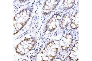 IHC analysis of AKAP 95/AKAP8 using anti-AKAP 95/AKAP8 antibody (ABIN7601553). (AKAP8 antibody  (AA 380-546))
