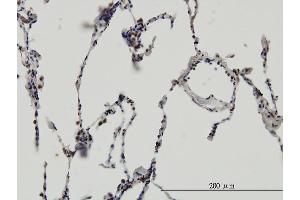 Immunoperoxidase of monoclonal antibody to ERH on formalin-fixed paraffin-embedded human lung. (ERH antibody  (AA 1-104))