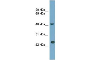 WB Suggested Anti-ART3 Antibody Titration:  0. (ART3 antibody  (Middle Region))