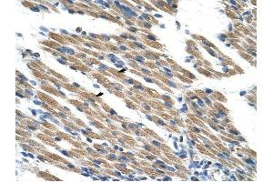 KEAP1 antibody was used for immunohistochemistry at a concentration of 4-8 ug/ml to stain Skeletal muscle cells (arrows) in Human Muscle. (KEAP1 antibody  (C-Term))