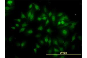 Immunofluorescence of monoclonal antibody to TUBG2 on HeLa cell.