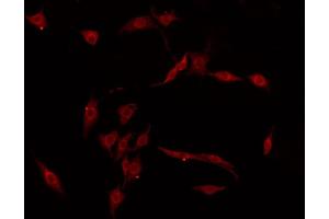 ABIN6274430 staining COLO205 by IF/ICC. (RGAG1 antibody)
