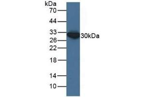 Detection of ECH1 in Human HepG2 Cells using Polyclonal Antibody to Enoyl Coenzyme A Hydratase 1, Peroxisomal (ECH1) (ECH1 antibody  (AA 1-328))