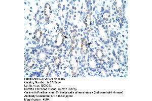 Human kidney (GTF2IRD1 antibody  (C-Term))