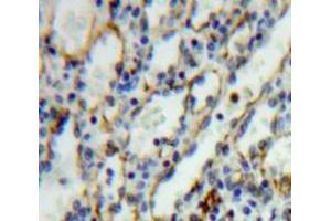 Used in DAB staining on fromalin fixed paraffin-embedded Spleen tissue (IL27 Receptor alpha antibody  (AA 117-350))