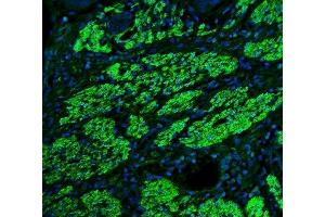 IF analysis of TAGLN/Transgelin using anti-TAGLN/Transgelin antibody (ABIN7600099). (Transgelin antibody  (AA 15-170))