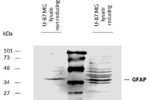 Detection of Glial fibrillary acidic protein (GFAP) by Western Blot. (GFAP antibody)