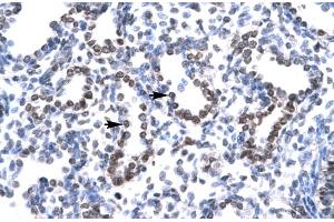 Immunohistochemistry (IHC) image for anti-Ha-Ry/enhancer-of-Split Related with YRPW Motif 1 (HEY1) (C-Term) antibody (ABIN2779686) (HEY1 antibody  (C-Term))