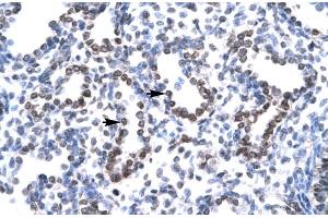 Immunohistochemistry (IHC) image for anti-Ha-Ry/enhancer-of-Split Related with YRPW Motif 1 (HEY1) (C-Term) antibody (ABIN2779686)