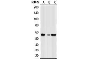 Western blot analysis of GLRB expression in HeLa (A), NIH3T3 (B), rat spleen (C) whole cell lysates.