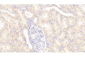 Detection of a2PI in Human Kidney Tissue using Polyclonal Antibody to Alpha 2-Antiplasmin (a2PI) (alpha 2 Antiplasmin antibody)