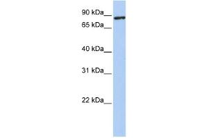 WB Suggested Anti-TMEM63A Antibody Titration:  0. (TMEM63A antibody  (N-Term))