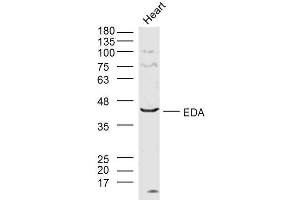 Lane 1: mouse heart lysates probed with EDA Polyclonal Antibody  at 1:300 overnight at 4˚C. (Ectodysplasin A antibody  (AA 101-200))