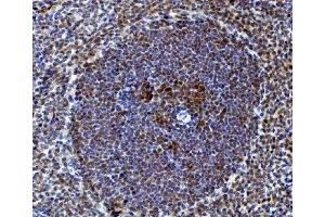 IHC analysis of Rad9/Rad9a using anti-Rad9/Rad9a antibody (ABIN7599342).