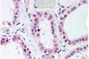 Immunohistochemistry (IHC) image for anti-Wingless-Type MMTV Integration Site Family, Member 4 (WNT4) (Internal Region) antibody (ABIN1049477)