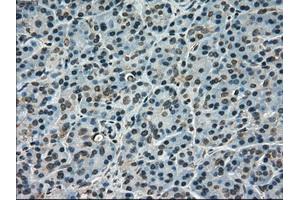 Immunohistochemical staining of paraffin-embedded pancreas tissue using anti-SCYL3mouse monoclonal antibody. (SCYL3 antibody)