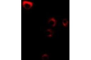 Immunofluorescent analysis of FDFT1 staining in MCF7 cells. (FDFT1 antibody)