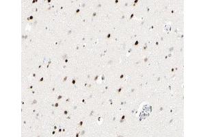 ABIN6266945 at 1/100 staining human brain tissue sections by IHC-P. (p300 antibody  (Internal Region))