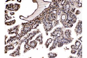 Immunohistochemistry (IHC) image for anti-Purine Nucleoside Phosphorylase (PNP) (AA 161-189), (Middle Region) antibody (ABIN4886701)
