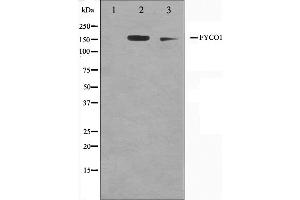 Western blot analysis on A549 and HuvEc cell lysate using FYCO1 Antibody,The lane on the left is treated with the antigen-specific peptide. (FYCO1 antibody  (Internal Region))