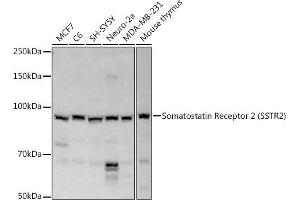 Western blot analysis of extracts of various cell lines, using Somatostatin Receptor 2 (SSTR2) antibody (ABIN3017442, ABIN3017443, ABIN3017444 and ABIN6220093) at 1:1000 dilution. (SSTR2 antibody  (C-Term))