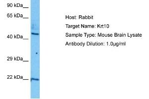 Host:  Mouse  Target Name:  KRT10  Sample Tissue:  Mouse Brain  Antibody Dilution:  1ug/ml (Keratin 10 antibody  (N-Term))