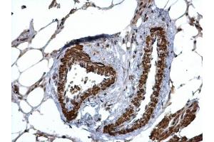 IHC-P Image HUS1 antibody detects HUS1 protein at cytosol and nucleus on mouse lymph node by immunohistochemical analysis. (HUS1 antibody  (Center))