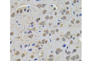 Immunohistochemistry of paraffin-embedded Rat brain using TGM1 Polyclonal Antibody at dilution of 1:100 (40x lens). (TGM1 antibody)