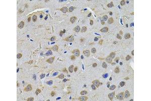 Immunohistochemistry of paraffin-embedded Rat brain using TGM1 Polyclonal Antibody at dilution of 1:100 (40x lens).