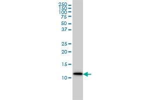 S100A9 monoclonal antibody (M01A), clone 1C10 Western Blot analysis of S100A9 expression in MCF-7 . (S100A9 antibody  (AA 1-114))