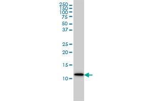 S100A9 monoclonal antibody (M01A), clone 1C10 Western Blot analysis of S100A9 expression in MCF-7 .