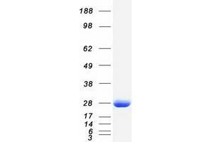 Western Blotting (WB) image for Fas (TNFRSF6)-Associated Via Death Domain (FADD) protein (Myc-DYKDDDDK Tag) (ABIN2720681)