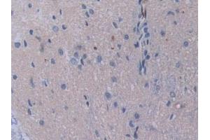 Detection of STAM1 in Rat Spinal cord Tissue using Polyclonal Antibody to Signal Transducing Adaptor Molecule 1 (STAM1)