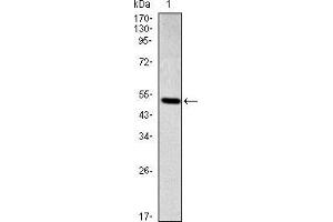 Western blot analysis using SMAD2 mAb against human SMAD2 (AA: 20-254) recombinant protein. (SMAD2 antibody)