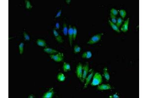 Immunofluorescent analysis of Hela cells using ABIN7149082 at dilution of 1:100 and Alexa Fluor 488-congugated AffiniPure Goat Anti-Rabbit IgG(H+L) (CDA antibody  (AA 1-146))