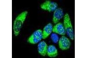 Confocal immunofluorescent analysis of WT1 Antibody (Center E361) with MCF-7 cell followed by Alexa Fluor® 488-conjugated goat anti-rabbit lgG (green). (WT1 antibody  (Middle Region))